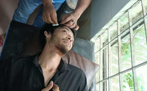 আবারও বহিরাগতের হামলার শিকার নারীসহ বাকৃবির ২ শিক্ষার্থী 